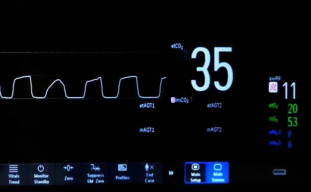 Accurate CO2 readings with a nasal cannula